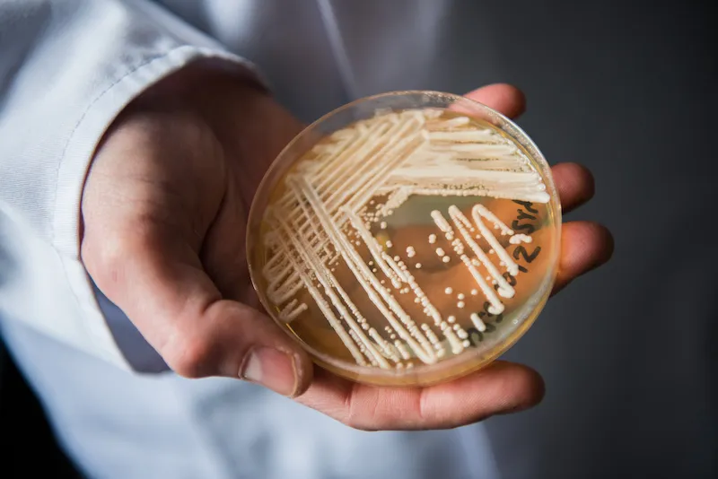 This Fungus Is Quickly Spreading, and Climate Change May Be to Blame