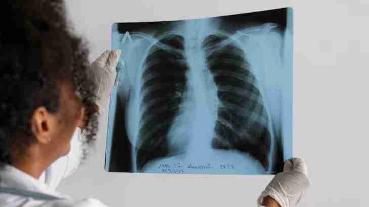 People with lung conditions face extra risks from climate change, reveals research