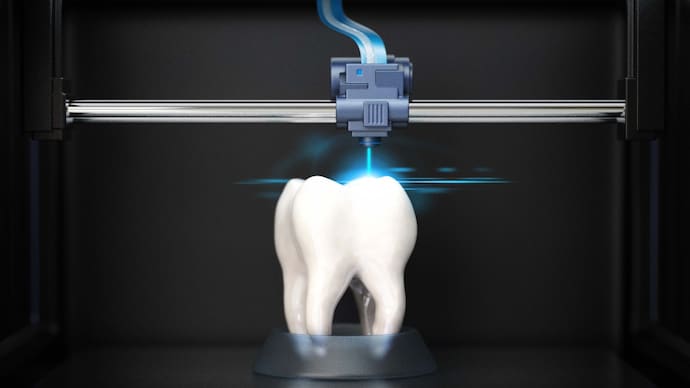 3D-printing your tooth: How an Indian breakthrough has changed dentistry